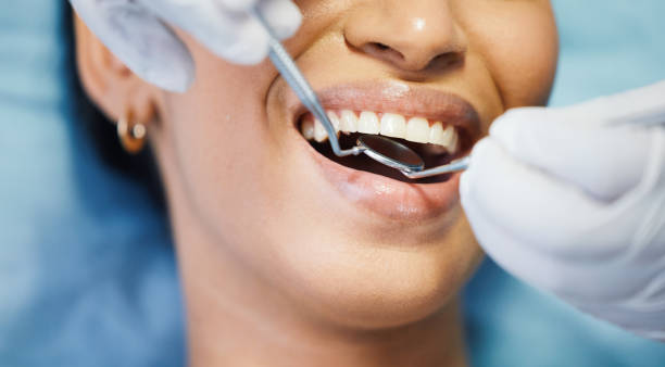 Best Emergency Dentist for Knocked-Out Tooth in Napa, CA