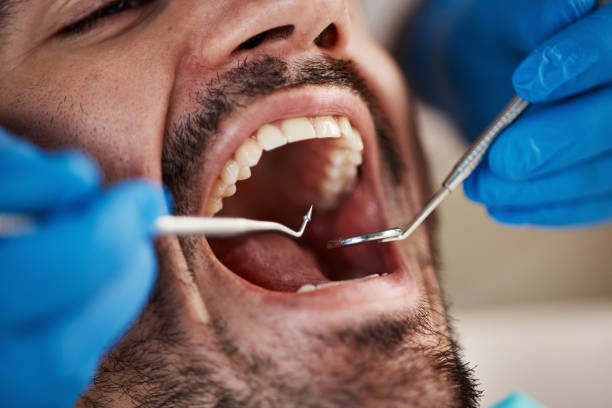 Best Broken or Cracked Tooth Emergency Dentist in Napa, CA