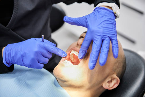 Best Emergency Dental Services for Seniors in Napa, CA