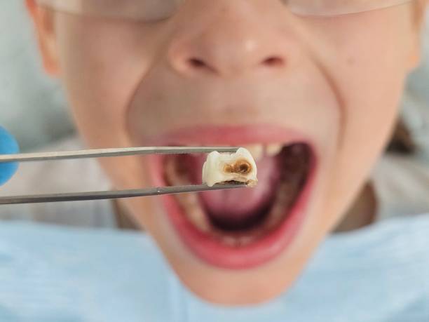 Best Mobile Emergency Dentist in Napa, CA